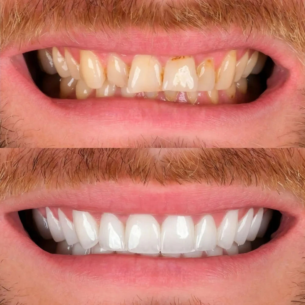 Real patients. Real transformations.