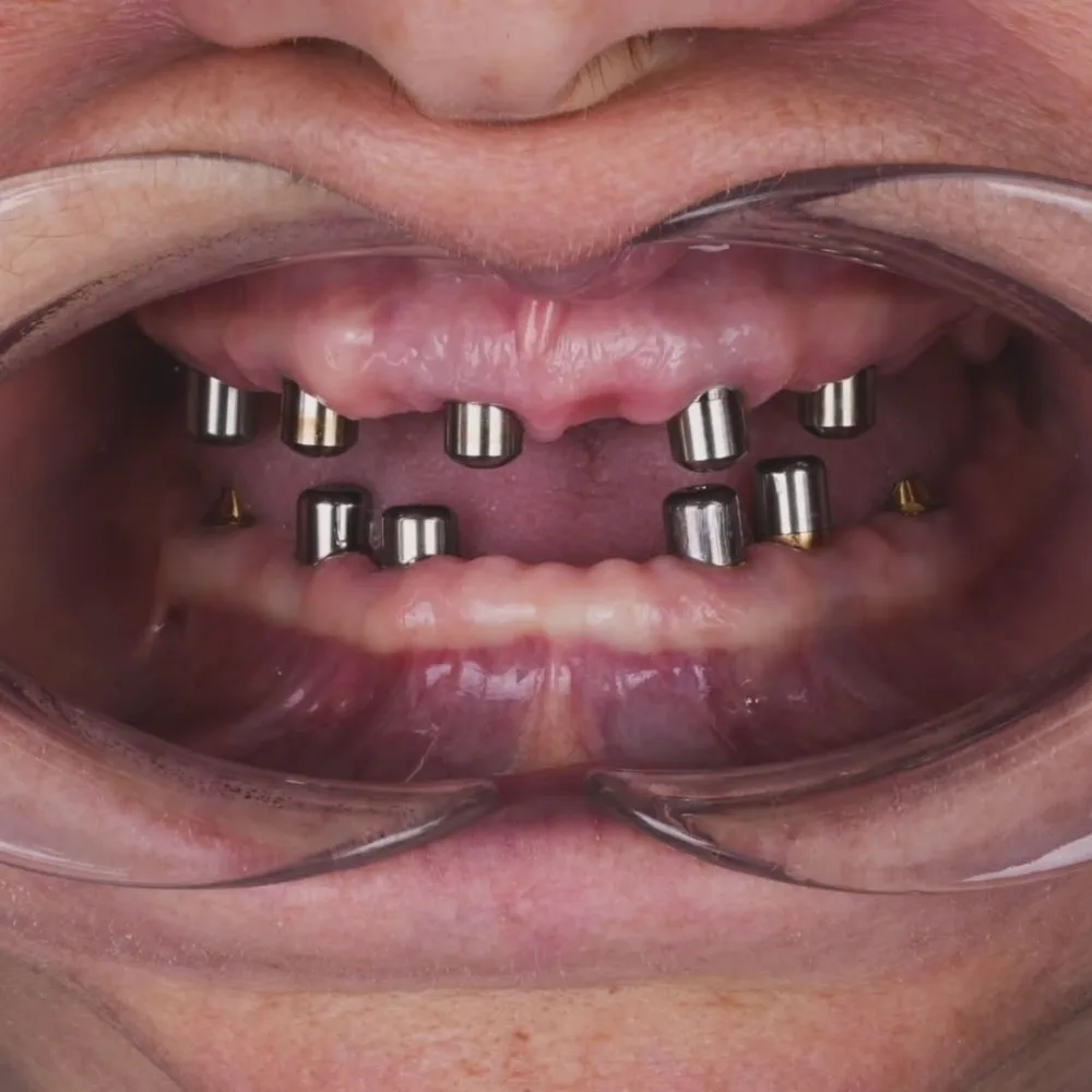 Real patients. Real transformations.