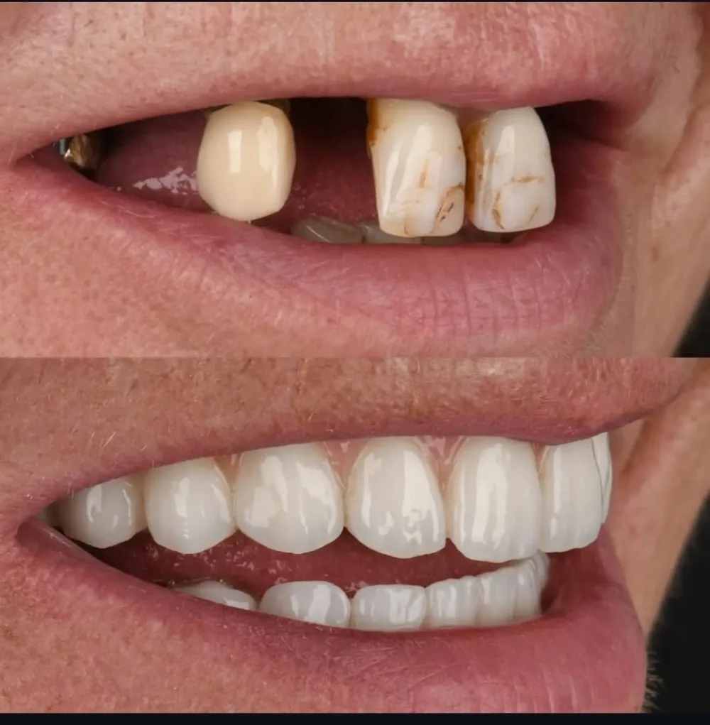 Real patients. Real transformations.