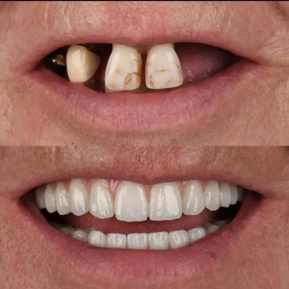Real patients. Real transformations.