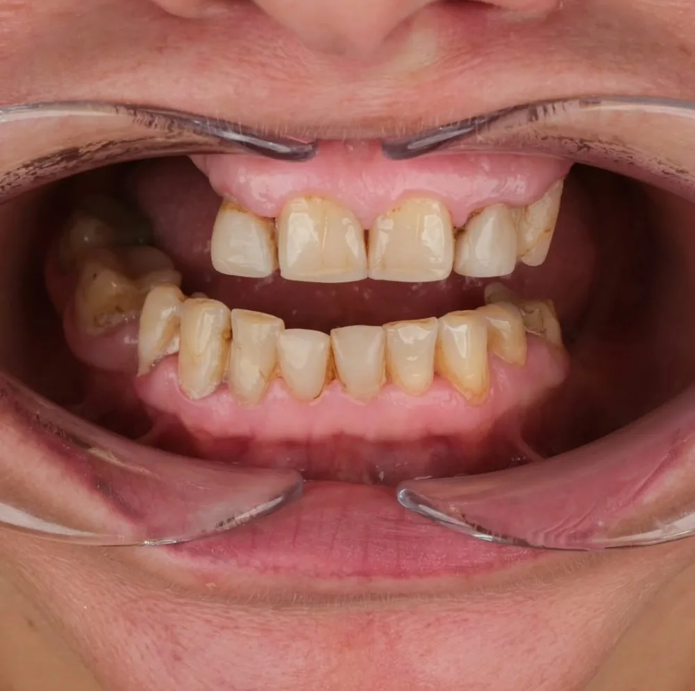 Real patients. Real transformations.