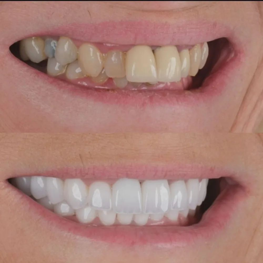 Real patients. Real transformations.