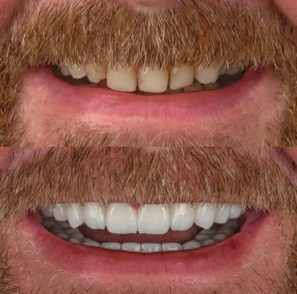 Real patients. Real transformations.