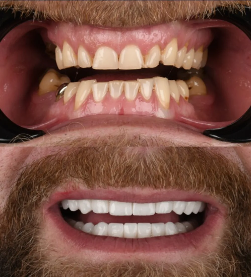 Real patients. Real transformations.