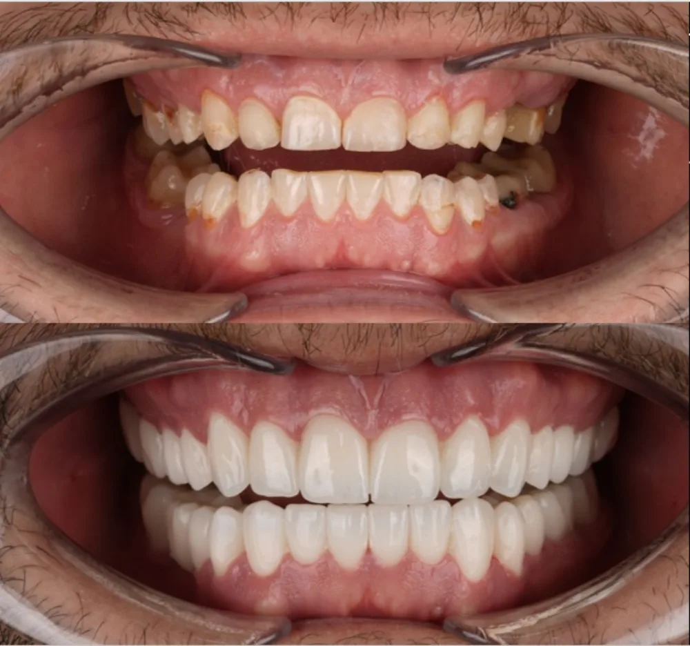 Real patients. Real transformations.