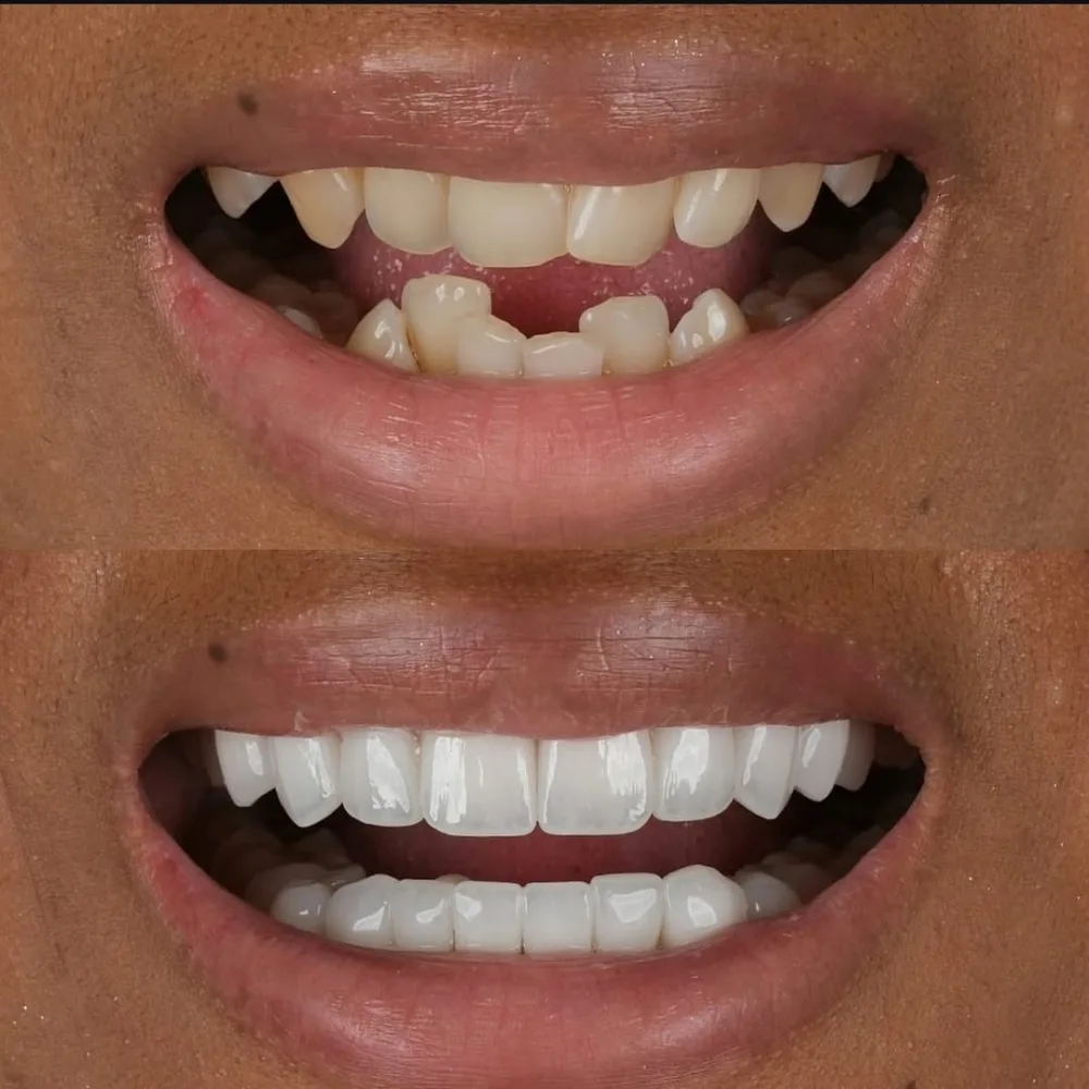 Real patients. Real transformations.