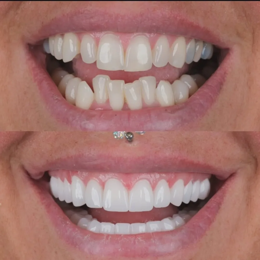 Real patients. Real transformations.