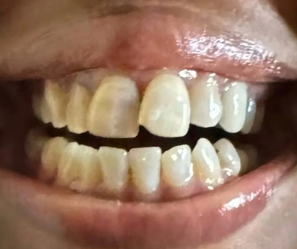 Real patients. Real transformations.
