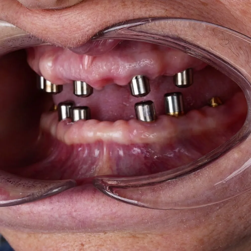 Real patients. Real transformations.