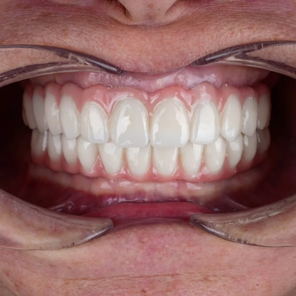 Real patients. Real transformations.