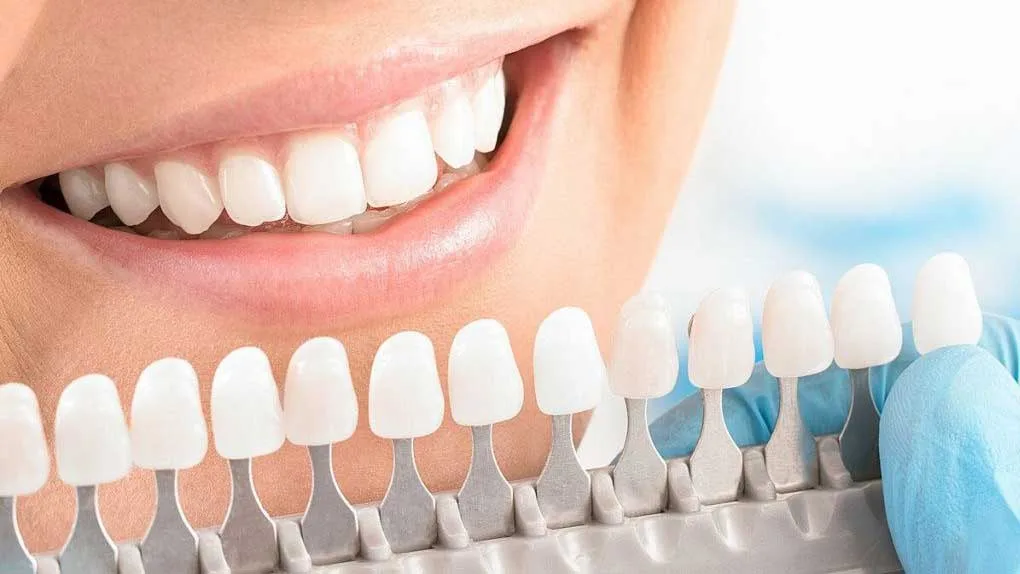 Zirconium Crowns